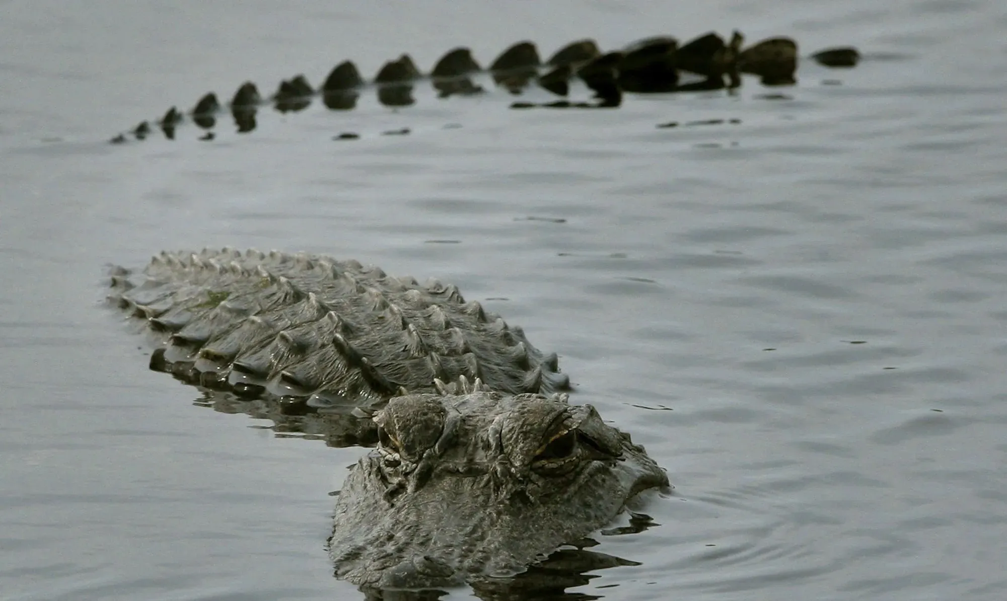 Alligator Bit Child on Closed New Orleans Beach
